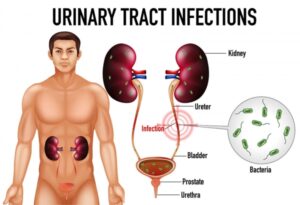 urinary tract infections treatment in nagpur