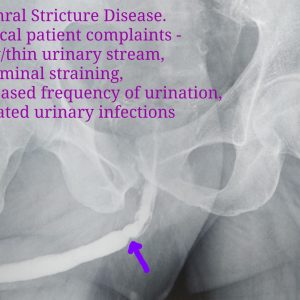urologist in nagpur