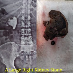 urologist in nagpur
