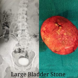 urologist in nagpur