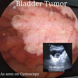 urologist in nagpur