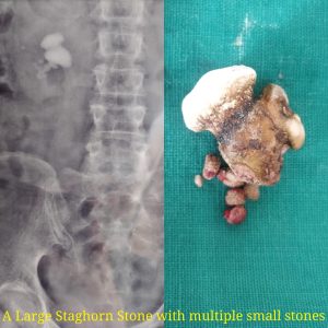 urologist in nagpur