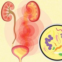 urinary tract infection treatment in nagpur
